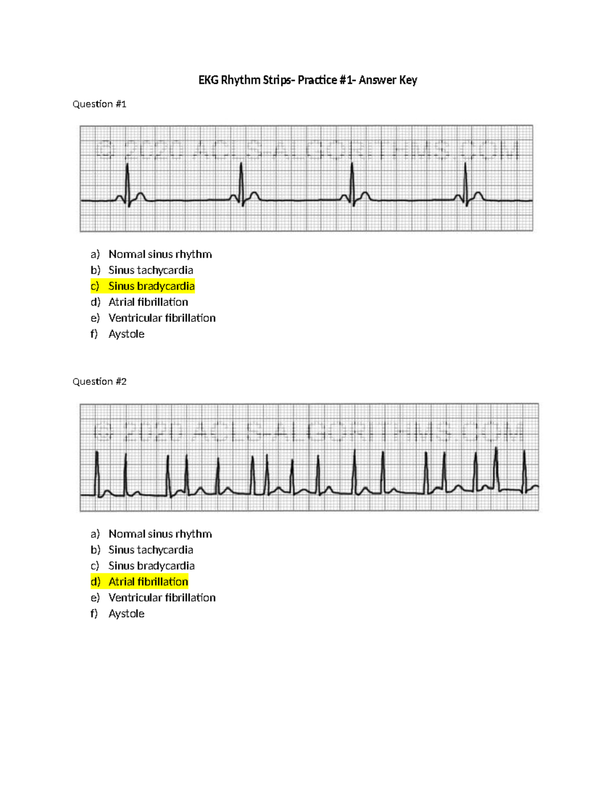 Ekg Practice Strips Printable