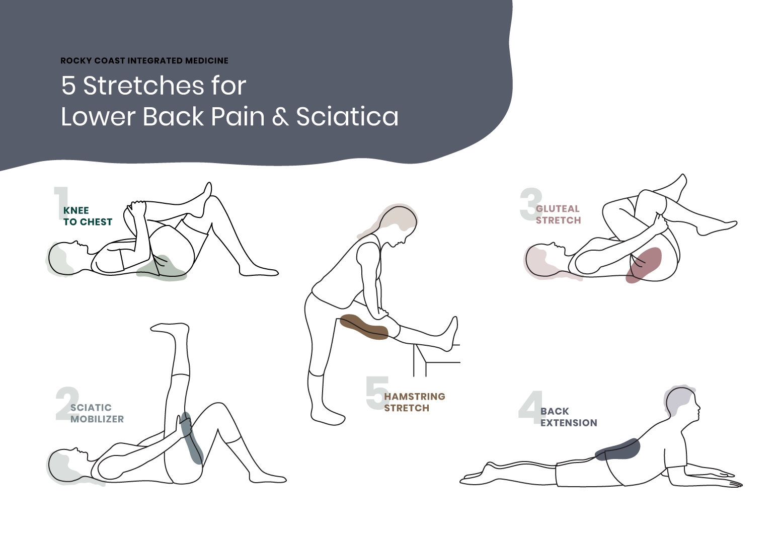 Printable Exercises For Sciatica Pain